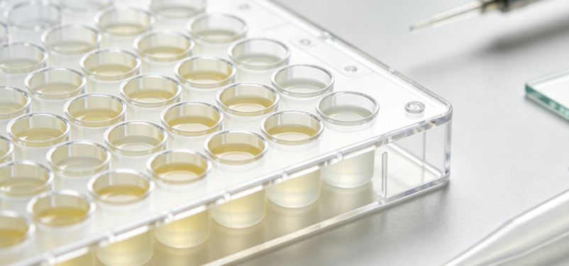 Sphingosine Kinase Detection and Activity Profiling